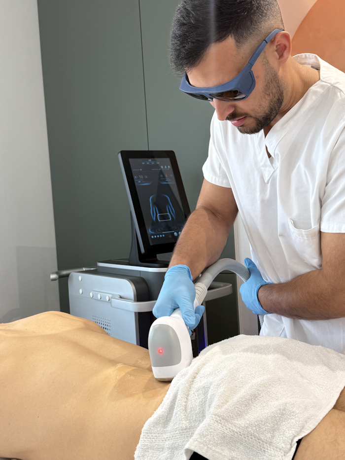 Épilation laser chez Nevalis à Nice